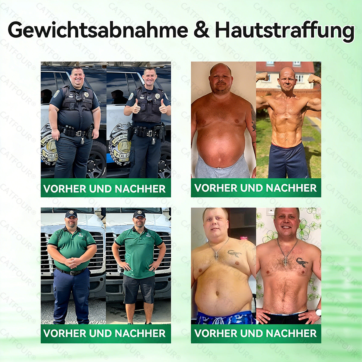 🇩🇪𝐎𝐟𝐟𝐢𝐳𝐢𝐞𝐥𝐥𝐞𝐫 𝐒𝐡𝐨𝐩 | 👩‍⚕️💃 𝐂𝐀𝐓𝐅𝐎𝐔𝐑®𝙈𝙤𝙧𝙞𝙣𝗴𝗮 · 𝗕𝗲𝗿𝗯𝗲𝗿𝒊𝒏 × 𝑵𝘼𝘿+ 10-𝙞𝙣-𝟏 𝐀𝐝𝐯𝐚𝗻𝗰𝗲𝗱 𝗡𝗮𝙣𝙤 𝙈𝙞𝙠𝙧𝐨𝐧𝐚𝐝𝐞𝐥-𝐏𝐚𝒕𝒄𝗵(𝐍𝐮𝐫 𝐞𝐢𝐧𝐦𝐚𝐥 𝐭ä𝐠𝐥𝐢𝐜𝐡, 𝐬𝐢𝐜𝐡𝐭𝐛𝐚𝐫𝐞 𝐕𝐞𝐫ä𝐧𝐝𝐞𝐫𝐮𝐧𝐠𝐞𝐧 𝐢𝐧 𝟕 𝐓𝐚𝐠𝐞𝐧)✅ 𝐅ü𝐫 𝐅𝐞𝐭𝐭𝐥𝐞𝐢𝐛𝐢𝐠𝐤𝐞𝐢𝐭, 𝐇𝐚𝐮𝐭𝐬𝐭𝐫𝐚𝐟𝐟𝐮𝐧𝐠, 𝐃𝐢𝐚𝐛𝐞𝐭𝐞𝐬, 𝐒𝐜𝐡𝐥𝐚𝐟𝐚𝐩𝐧𝐨𝐞, 𝐆𝐞𝐥𝐞𝐧𝐤𝐩𝐫𝐨𝐛𝐥𝐞𝐦𝐞 𝐮𝐧𝐝 𝐦𝐞𝐡𝐫!