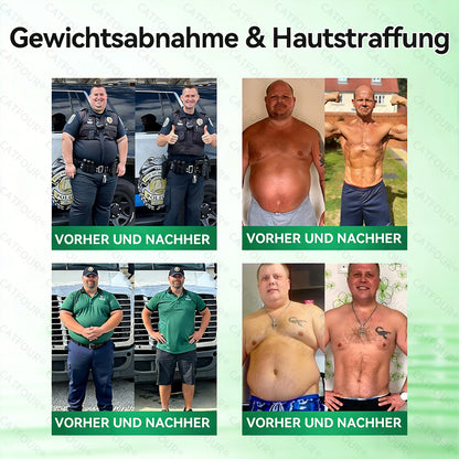 🇩🇪𝐎𝐟𝐟𝐢𝐳𝐢𝐞𝐥𝐥𝐞𝐫 𝐒𝐡𝐨𝐩 | 👩‍⚕️💃 𝐂𝐀𝐓𝐅𝐎𝐔𝐑®𝙈𝙤𝙧𝙞𝙣𝗴𝗮 · 𝗕𝗲𝗿𝗯𝗲𝗿𝒊𝒏 × 𝑵𝘼𝘿+ 10-𝙞𝙣-𝟏 𝐀𝐝𝐯𝐚𝗻𝗰𝗲𝗱 𝗡𝗮𝙣𝙤 𝙈𝙞𝙠𝙧𝐨𝐧𝐚𝐝𝐞𝐥-𝐏𝐚𝒕𝒄𝗵(𝐍𝐮𝐫 𝐞𝐢𝐧𝐦𝐚𝐥 𝐭ä𝐠𝐥𝐢𝐜𝐡, 𝐬𝐢𝐜𝐡𝐭𝐛𝐚𝐫𝐞 𝐕𝐞𝐫ä𝐧𝐝𝐞𝐫𝐮𝐧𝐠𝐞𝐧 𝐢𝐧 𝟕 𝐓𝐚𝐠𝐞𝐧)✅ 𝐅ü𝐫 𝐅𝐞𝐭𝐭𝐥𝐞𝐢𝐛𝐢𝐠𝐤𝐞𝐢𝐭, 𝐇𝐚𝐮𝐭𝐬𝐭𝐫𝐚𝐟𝐟𝐮𝐧𝐠, 𝐃𝐢𝐚𝐛𝐞𝐭𝐞𝐬, 𝐒𝐜𝐡𝐥𝐚𝐟𝐚𝐩𝐧𝐨𝐞, 𝐆𝐞𝐥𝐞𝐧𝐤𝐩𝐫𝐨𝐛𝐥𝐞𝐦𝐞 𝐮𝐧𝐝 𝐦𝐞𝐡𝐫!